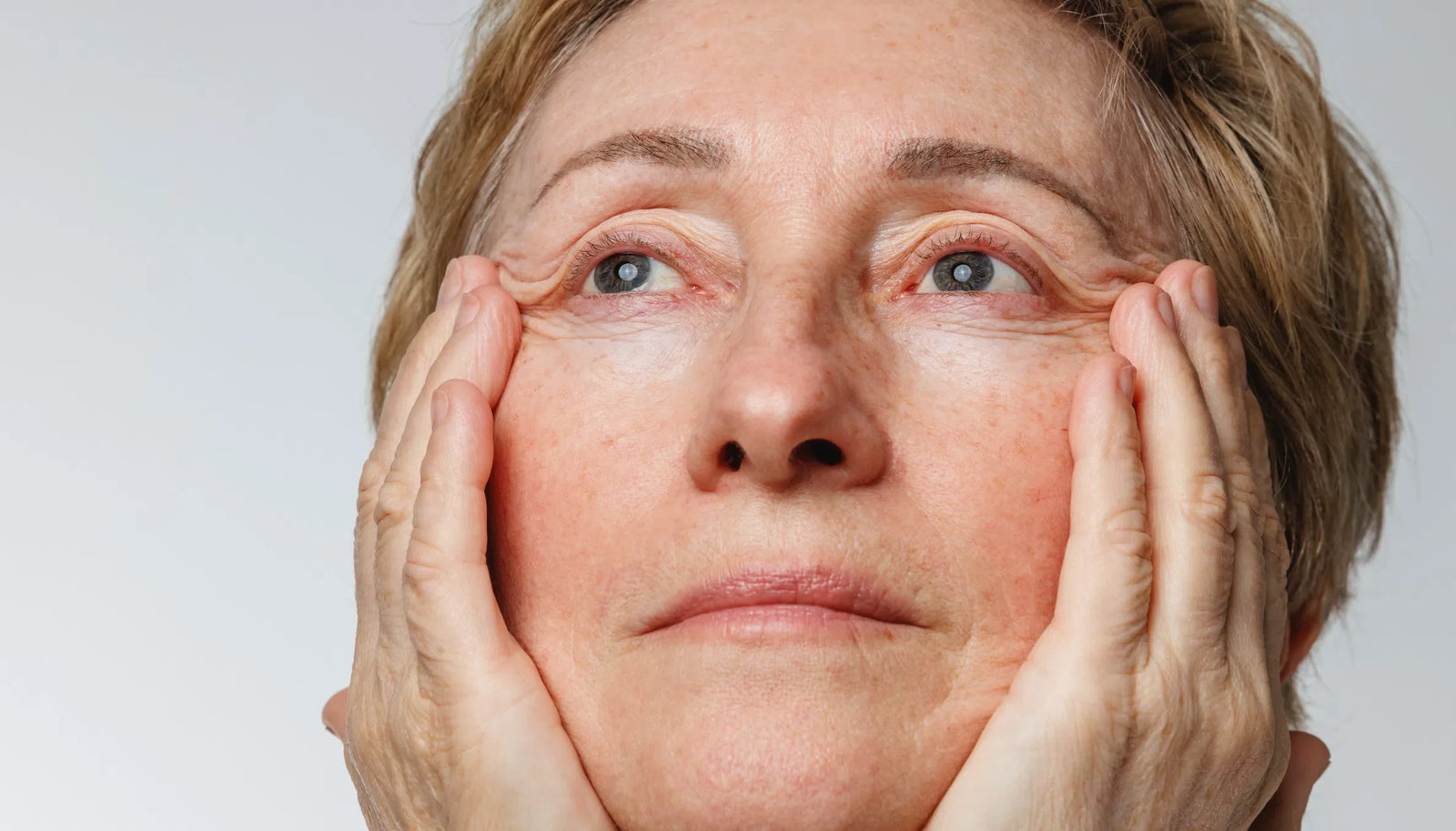 Aging Skin